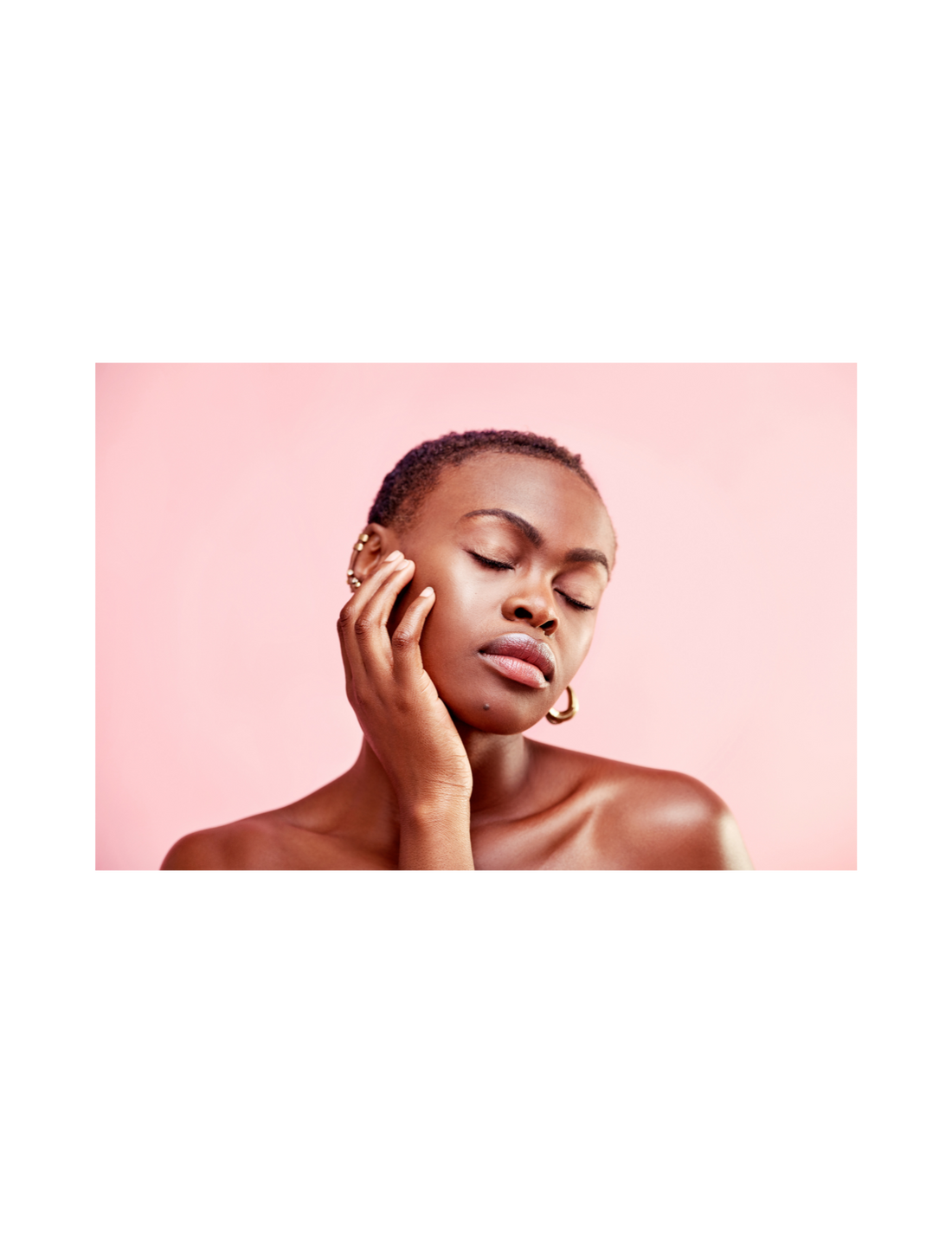 Tips to combat hyper-pigmentation and acne scars